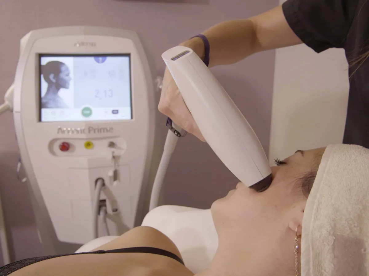 Radiofréquence Accent Prime sur l'ovale du visage